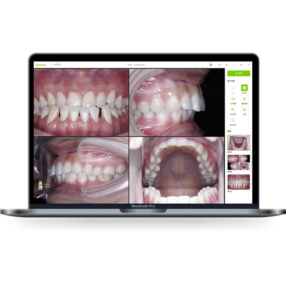 Intraoral Camera ES 100