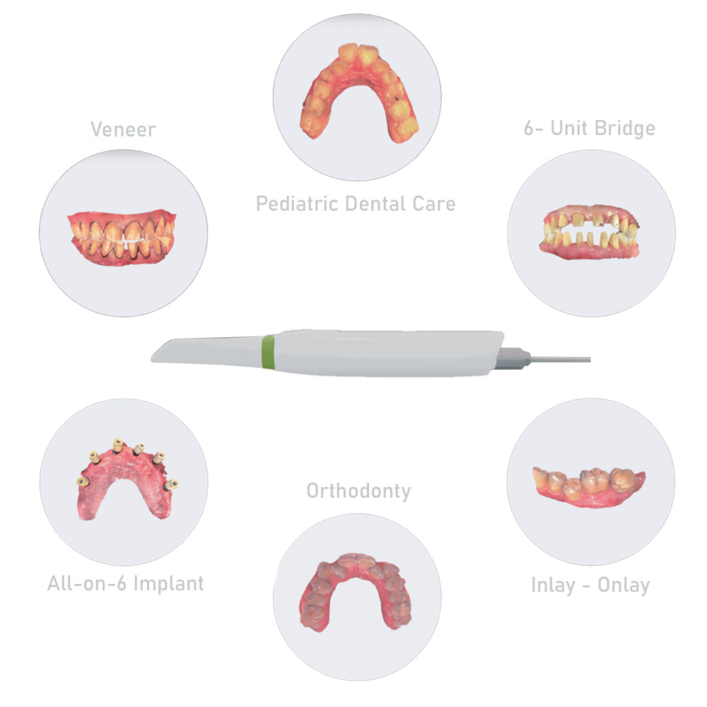 Intraoral Scanner