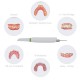 Intraoral Scanner