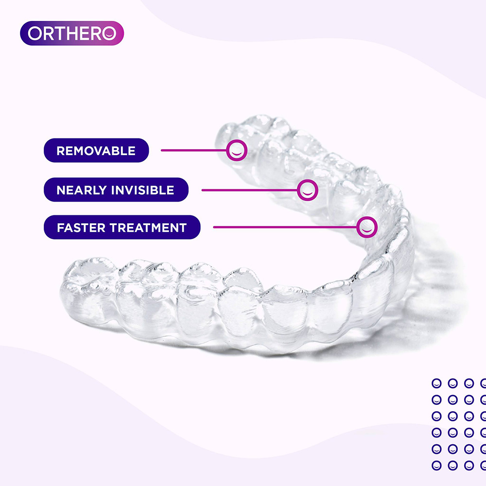 ORTHERO ALIGNERS