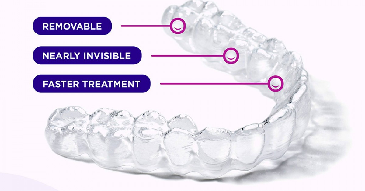 Orthero ORTHERO ALIGNERS